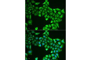 Immunofluorescence analysis of HeLa cells using ASL antibody (ABIN5973767). (ASL anticorps)