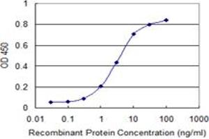 anti-UPF1 Regulator of Nonsense Transcripts Homolog (UPF1) (AA 1019-1116) antibody