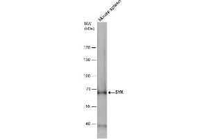 WB Image SYK antibody detects SYK protein by western blot analysis.