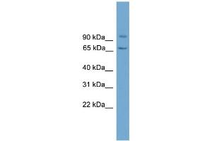 WB Suggested Anti-LOH11CR2A Antibody Titration: 0. (VWA5A anticorps  (N-Term))