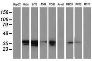 Image no. 4 for anti-Microtubule-Associated Protein, RP/EB Family, Member 2 (MAPRE2) antibody (ABIN1499321)