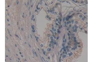 Detection of MPP6 in Human Prostate Tissue using Polyclonal Antibody to Membrane Protein, Palmitoylated 6 (MPP6)