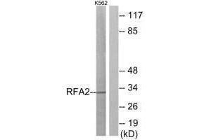 Western blot analysis of extracts from K562 cells, using RFA2 (Ab-21) antibody. (RPA2 anticorps  (Thr21))