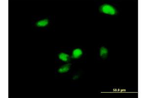Immunofluorescence of purified MaxPab antibody to YBX2 on HeLa cell. (YBX2 anticorps  (AA 1-364))
