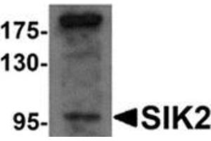 Western blot analysis of SIK2 in SW480 cell lysate with SIK2 antibody at 1 μg/ml. (SIK2 anticorps  (Center))