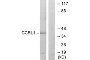 Western Blotting (WB) image for anti-Chemokine (C-C Motif) Receptor-Like 1 (CCRL1) (AA 5-54) antibody (ABIN2890756) (CCRL1 anticorps  (AA 5-54))