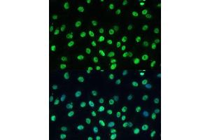 Immunofluorescence analysis of C6 cells using K/K/TRIM28 Polyclonal Antibody  at dilution of 1:100 (40x lens). (KAP1 anticorps  (AA 576-835))