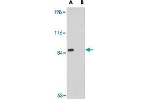 Western blot analysis of RIMS2 in rat brain tissue lysate with RIMS2 polyclonal antibody  at 1 ug/mL in the (A) absence or (B) presence of blocking peptide.