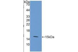 WB of Protein Standard: different control antibodies against Highly purified E.
