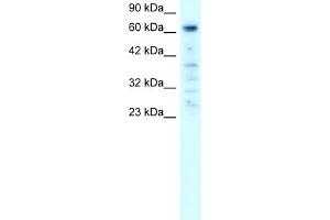 WB Suggested Anti-PAntibody Titration:  0. (PARP3 anticorps  (C-Term))