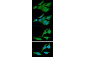 ICC/IF analysis of CRADD in HeLa cells line, stained with DAPI (Blue) for nucleus staining and monoclonal anti-human CRADD antibody (1:100) with goat anti-mouse IgG-Alexa fluor 488 conjugate (Green). (CRADD anticorps)