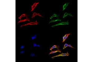 ABIN6263296 and ABIN6266592 staining Hela cells by IF/ICC. (MMP15 anticorps  (C-Term))