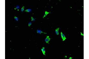 Immunofluorescence staining of SH-SY5Y cells with ABIN7157554 at 1:133, counter-stained with DAPI.