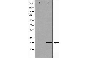Western blot analysis of Hela cell lysate, using RAMP2 Antibody. (RAMP2 anticorps  (Internal Region))