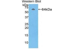 Western Blotting (WB) image for anti-alpha-Fetoprotein (AFP) (AA 31-576) antibody (ABIN1857934)