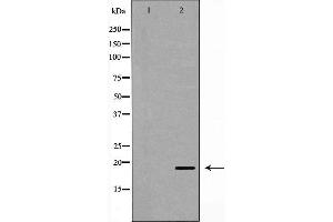 Western blot analysis of Hela whole cell lysates, using UBE2C Antibody. (UBE2C anticorps  (C-Term))