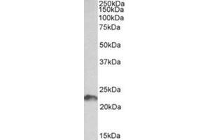 Western Blotting (WB) image for anti-Leukemia Inhibitory Factor (LIF) (AA 28-39), (Internal Region) antibody (ABIN1449476) (LIF anticorps  (Internal Region))