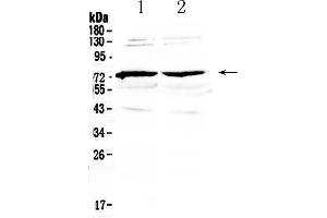 Western blot analysis of GAS 6 using anti-GAS 6 antibody . (GAS6 anticorps  (AA 488-660))