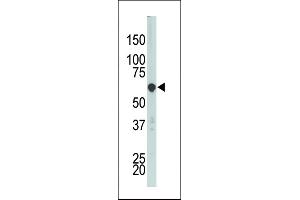 The anti-PCTK3 Pab (ABIN391790 and ABIN2841646) is used in Western blot to detect PCTK3 in HL-60 cell lysate.