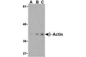 Western Blotting (WB) image for anti-Actin, beta (ACTB) (N-Term) antibody (ABIN2477265) (beta Actin anticorps  (N-Term))