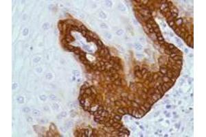 Anti-BAX antibody Immunohistochemistry  anti-BAX monoclonal antibody (Rabbit) was used to detect BAX in human esophagus.