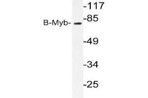 Western blot analysis of B-Myb antibody in extracts from K562 cells. (MYBL2 anticorps)