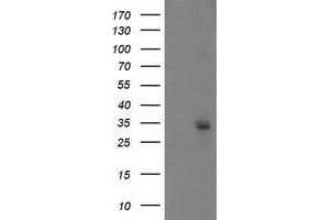 Western Blotting (WB) image for anti-phosphoglycerate Mutase 2 (Muscle) (PGAM2) antibody (ABIN1500171)