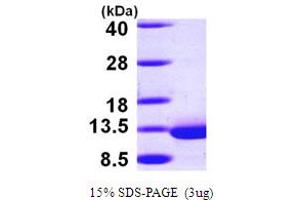 SDS-PAGE (SDS) image for Dynein, Light Chain, Roadblock Type 1 (DYNLRB1) (AA 1-96) protein (His tag) (ABIN667168) (DYNLRB1 Protein (AA 1-96) (His tag))
