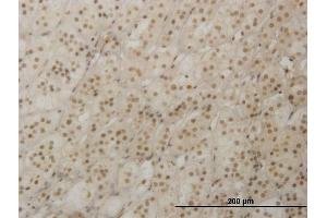 Immunoperoxidase of monoclonal antibody to RAX on formalin-fixed paraffin-embedded human adrenal gland.