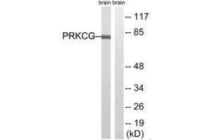 Western blot analysis of extracts from Rat brain cells, using PRKCG(Ab-655) antibody.