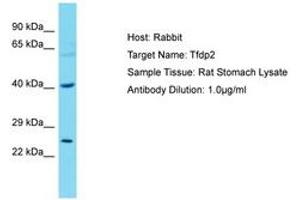 Image no. 1 for anti-Transcription Factor Dp-2 (E2F Dimerization Partner 2) (TFDP2) (AA 51-100) antibody (ABIN6750289)