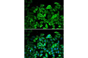 Immunofluorescence analysis of HeLa cells using ANXA1 antibody. (Annexin a1 anticorps)