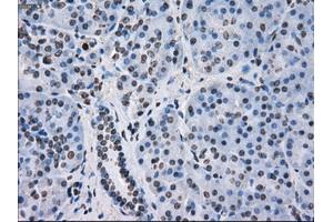Immunohistochemical staining of paraffin-embedded colon tissue using anti-FKBP5mouse monoclonal antibody. (FKBP5 anticorps)
