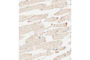 Immunohistochemical analysis of paraffin-embedded human skeletal muscle tissue using (ABIN392570 and ABIN2842109) performed on the Leica® BOND RXm.