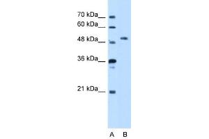 WB Suggested Anti-STK39 Antibody Titration:  5. (STK39 anticorps  (N-Term))