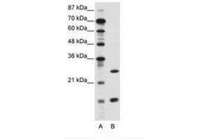 Image no. 1 for anti-CCAAT/enhancer Binding Protein (C/EBP), gamma (CEBPG) (AA 11-60) antibody (ABIN6736115) (CEBPG anticorps  (AA 11-60))