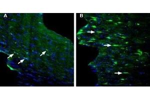 Expression of GPR84 in mouse fornix in a kainic acid-induced model of temporal lobe epilepsy - Immunohistochemical staining of perfusion-fixed frozen mouse brain sections with Anti-GPR84 (extracellular) Antibody (ABIN7043175, ABIN7044443 and ABIN7044444), (1:200), followed by goat anti-rabbit-AlexaFluor-488.