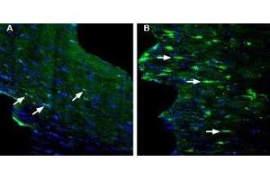 Expression of GPR84 in mouse fornix in a kainic acid-induced model of temporal lobe epilepsy - Immunohistochemical staining of perfusion-fixed frozen mouse brain sections with Anti-GPR84 (extracellular) Antibody (ABIN7043175, ABIN7044443 and ABIN7044444), (1:200), followed by goat anti-rabbit-AlexaFluor-488. (GPR84 anticorps  (2nd Extracellular Loop))
