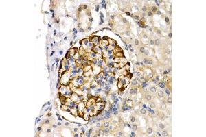 Immunohistochemistry of paraffin-embedded rat kidney using LIPG antibody (ABIN5975340) at dilution of 1/200 (40x lens). (LIPG anticorps)