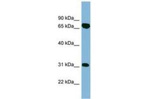 Image no. 1 for anti-HIRA Interacting Protein 3 (HIRIP3) (AA 395-444) antibody (ABIN6742134) (HIRIP3 anticorps  (AA 395-444))