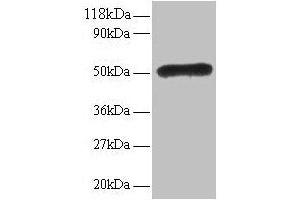 Western blot All lanes: LMO1 antibody at 2 μg/mL Lane 1: EC109 whole cell lysate Lane 2: 293T whole cell lysate Secondary Goat polyclonal to rabbit IgG at 1/15000 dilution Predicted band size: 18 kDa Observed band size: 50 kDa (LMO1 anticorps  (AA 5-156))
