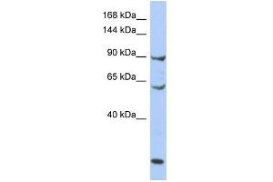 WB Suggested Anti-MCM8 Antibody Titration:  0. (MCM8 anticorps  (N-Term))
