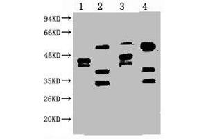 Western blot analysis of 1) Hela, 2) HepG2, 3) 293T, 4) Jurkat, diluted at 1:2000. (ERCC1 anticorps)