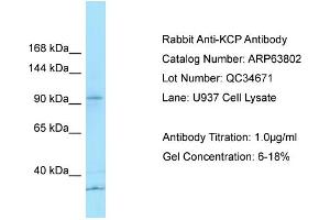 Western Blotting (WB) image for anti-Kielin/Chordin-Like Protein (KCP) (N-Term) antibody (ABIN2789631) (KCP anticorps  (N-Term))