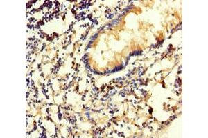 Immunohistochemistry of paraffin-embedded human appendix tissue using ABIN7170541 at dilution of 1:100 (Spermidine Synthase anticorps  (AA 17-302))