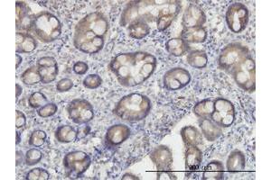 Immunoperoxidase of monoclonal antibody to OXSR1 on formalin-fixed paraffin-embedded human small Intestine. (OXSR1 anticorps  (AA 1-527))