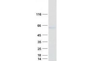 Validation with Western Blot