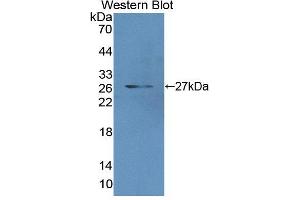 Figure. (MCCC2 anticorps  (AA 337-563))