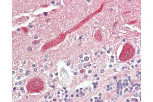 Anti-FADS1 antibody IHC staining of human brain, cerebellum. (FADS1 anticorps  (AA 303-332))