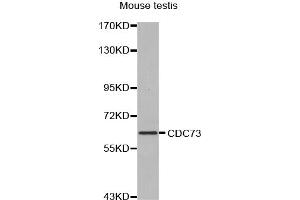 Western blot analysis of extracts of mouse testis, using CDC73 antibody (ABIN5970235). (HRPT2 anticorps)